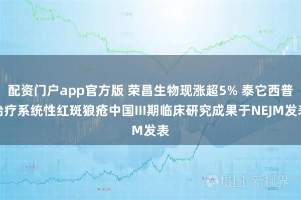 配资门户app官方版 荣昌生物现涨超5% 泰它西普治疗系统性红斑狼疮中国III期临床研究成果于NEJM发表